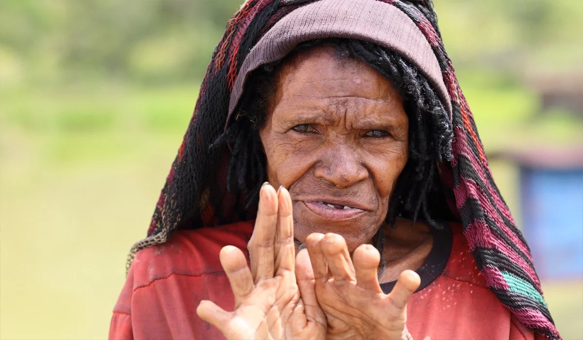 Tradisi Ikipalin, Potong Jari Saat Kehilangan Orang Tercinta Tradisi Ikipalin, Potong Jari Saat Kehilangan Orang Tercinta