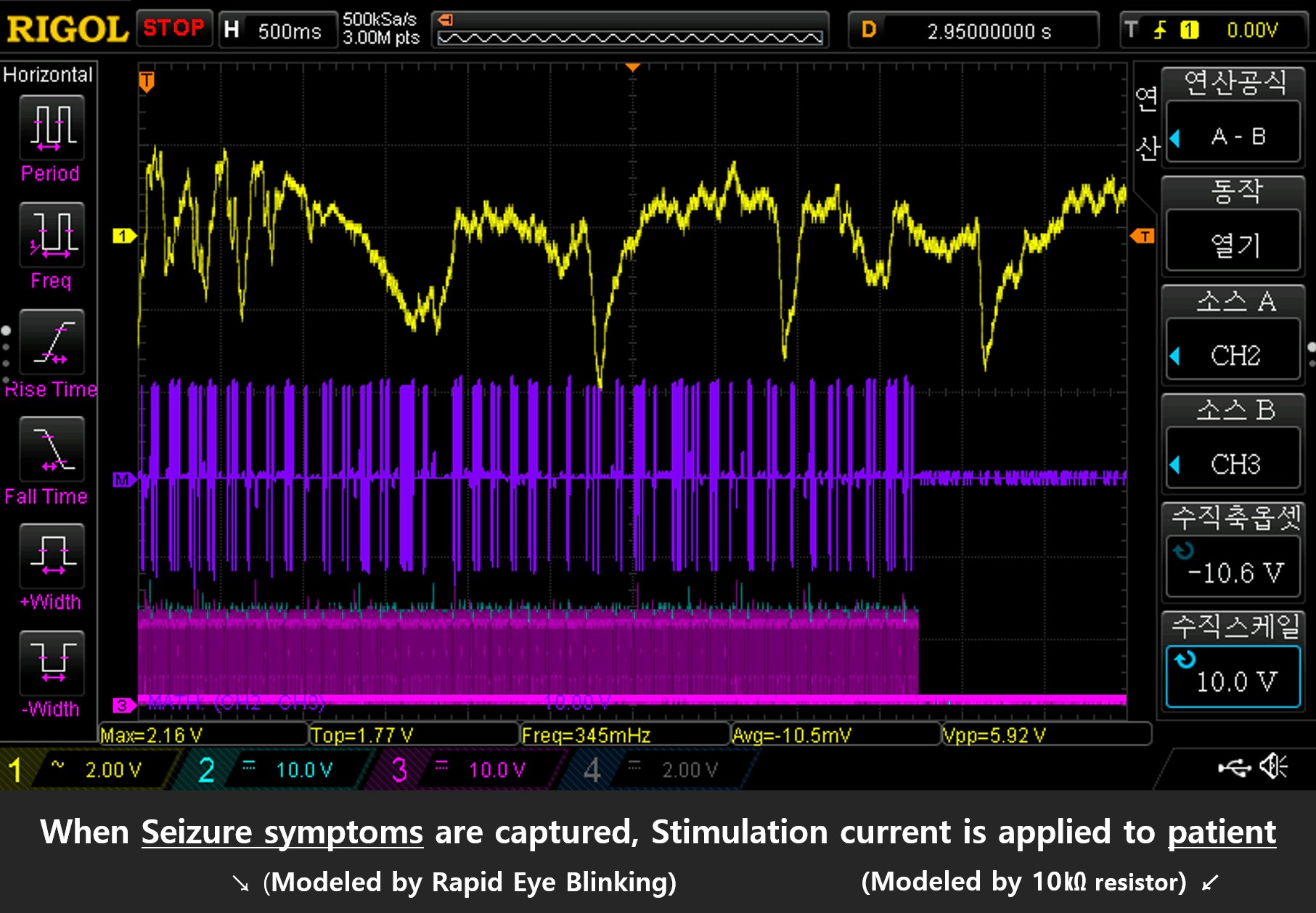 Bi-phasic Stimulation Pulse (1)