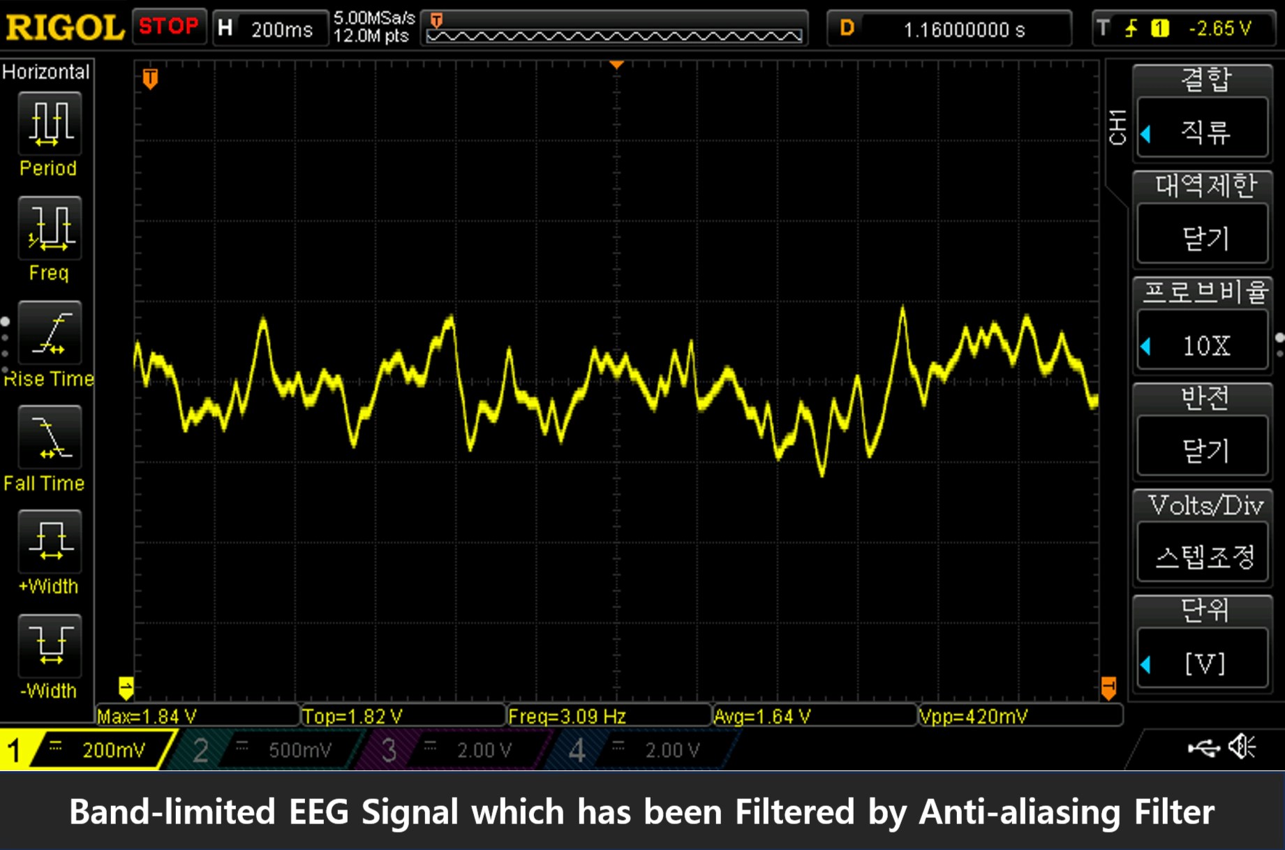 Frequency Response (2)_modified
