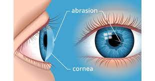 cornea
