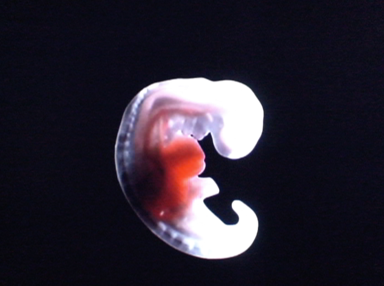 TLS_Projection-2_Eye-Foetus-1_web_1