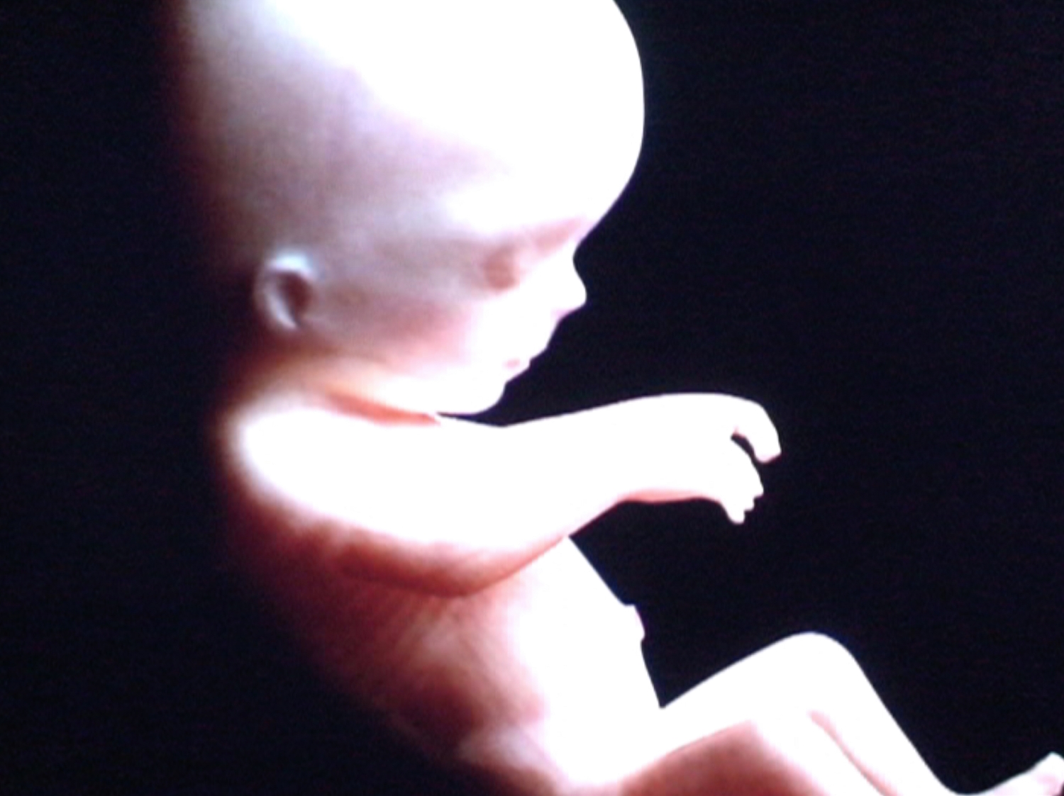 TLS_Projection-2_Eye-Foetus-2_web_1