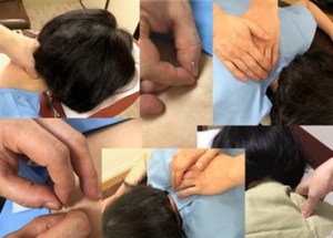 鍼とマッサージの施術の様子