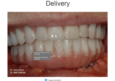 Smart Denture conversion result