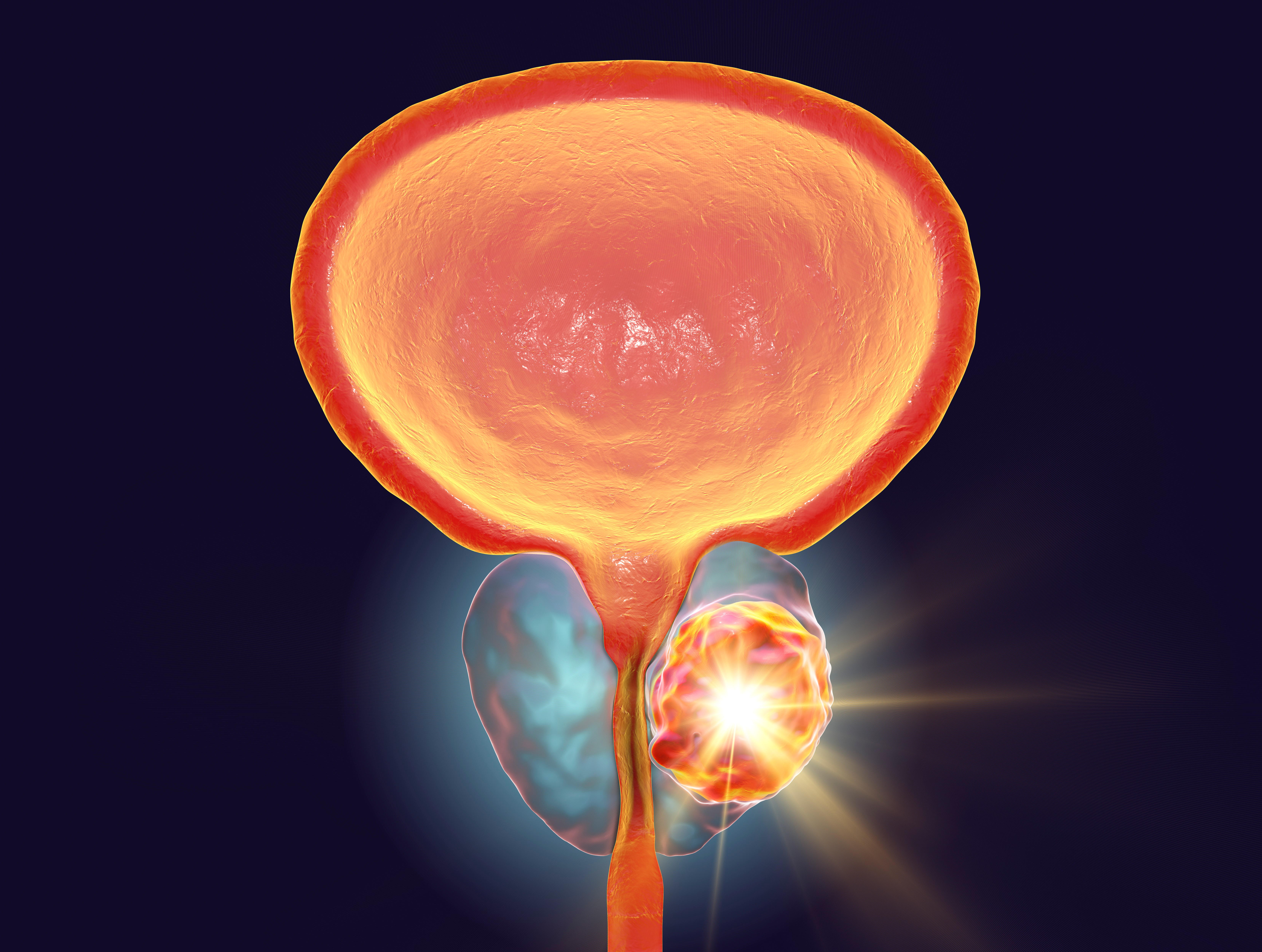 Optimal Duration of Androgen-Deprivation Therapy for Prostate Cancer (2026)