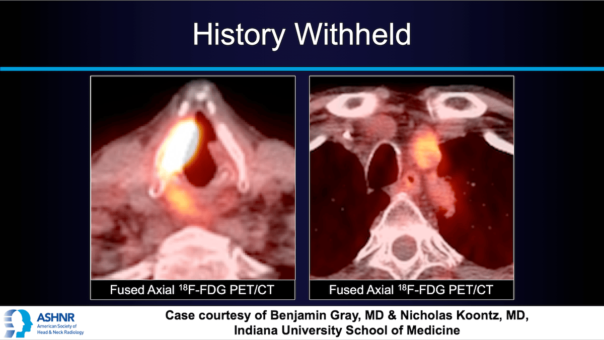 Case 67