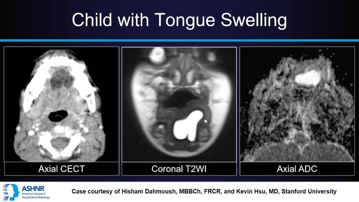 Case 20