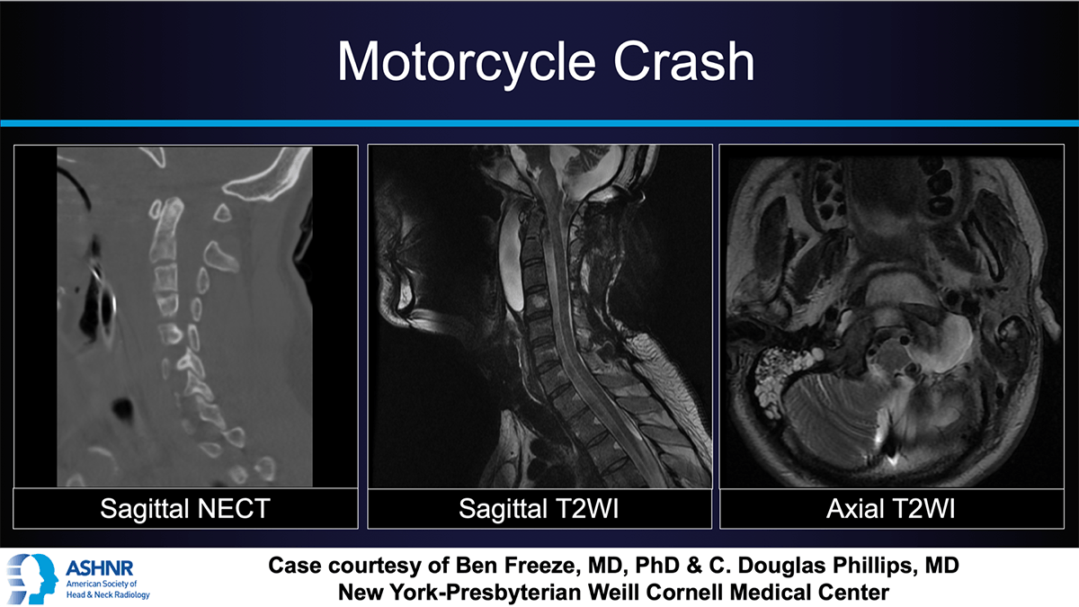 Case 56