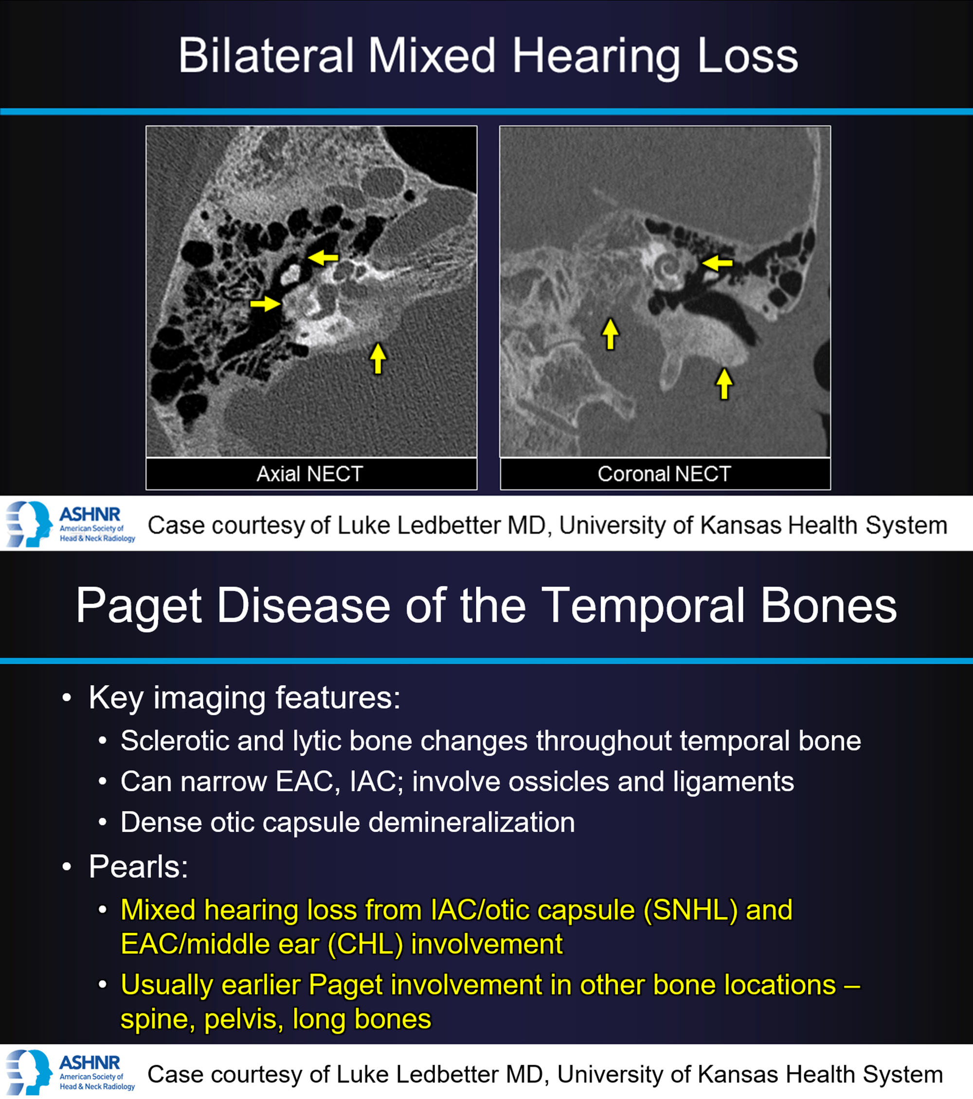 Case 6.2