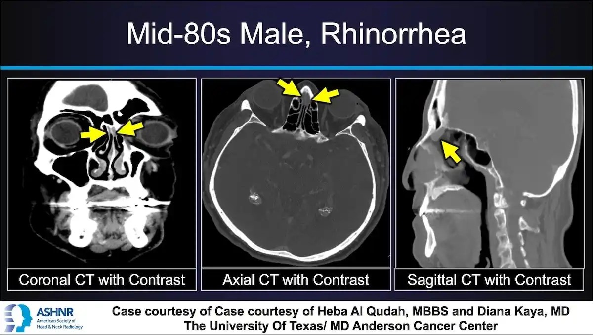 Case 296.2