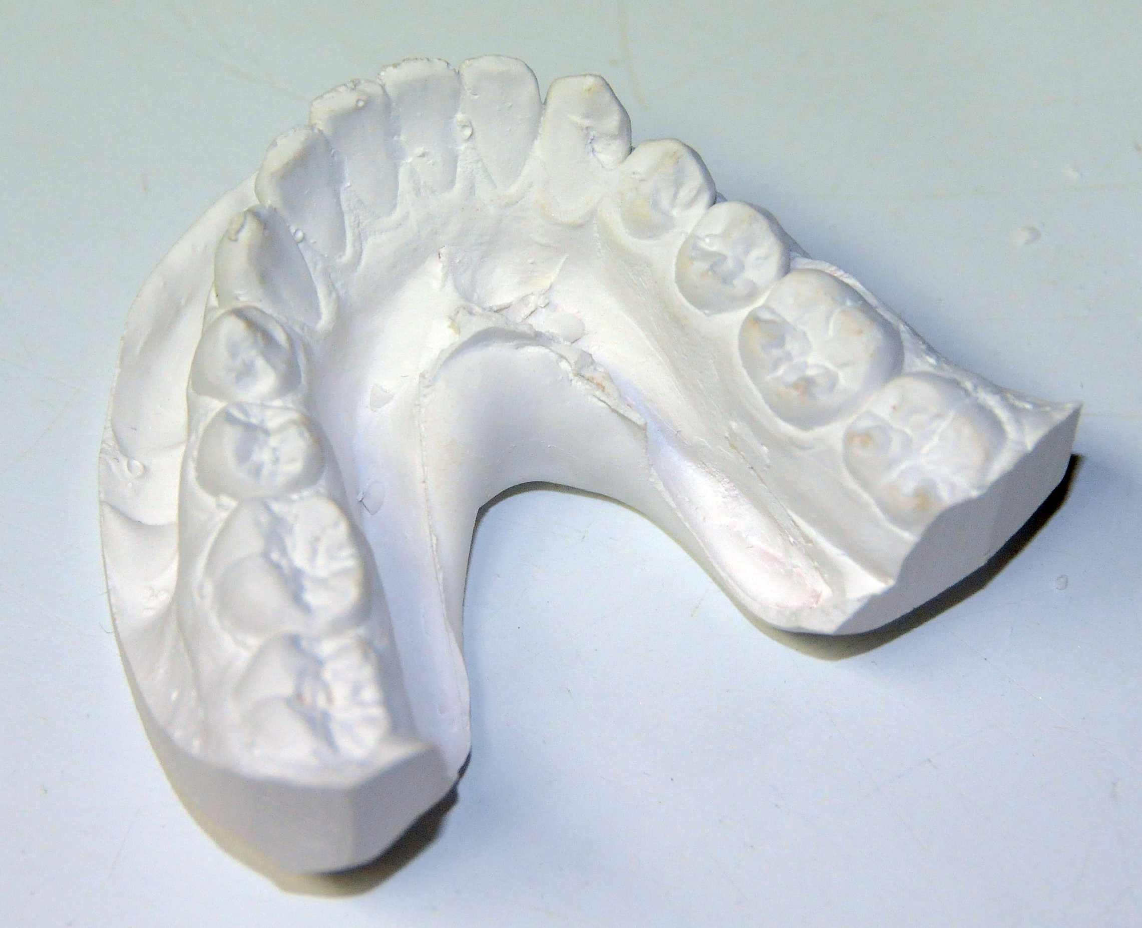 How are Orthodontic Hawley Retainers Made? Ask an