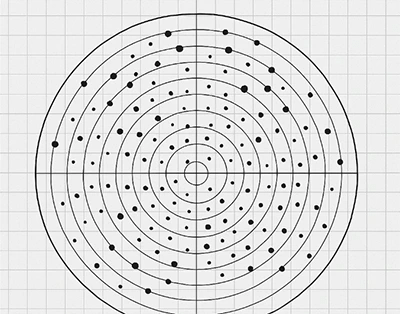 Automated Visual Field / Perimetry