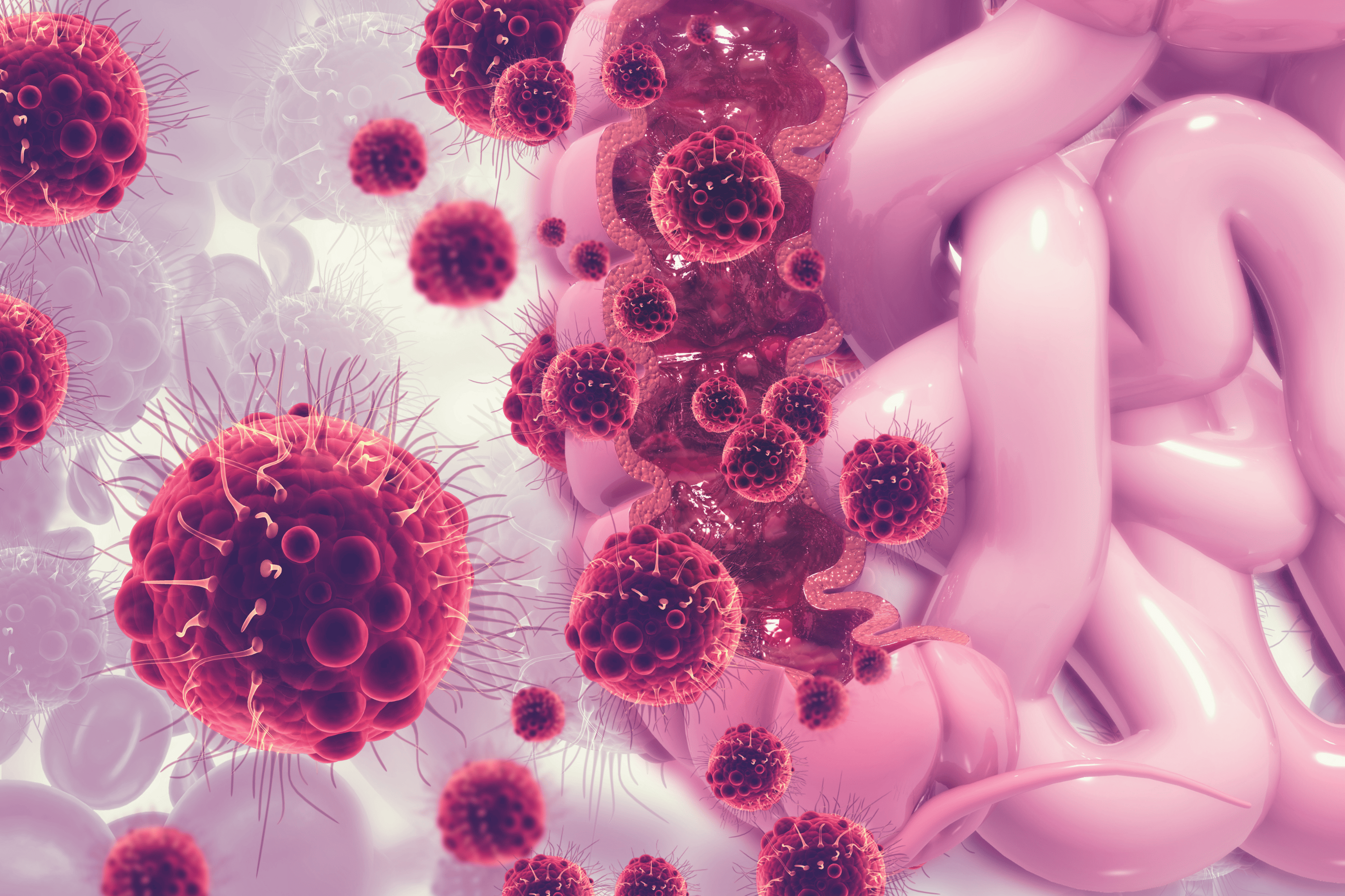 Scientists finally solve how common gut bacteria triggers colon cancer