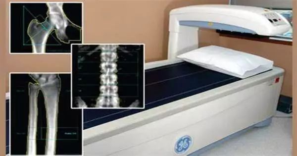 Densitometry Assignment Point - High Resolution Nature Pictures for Desktop