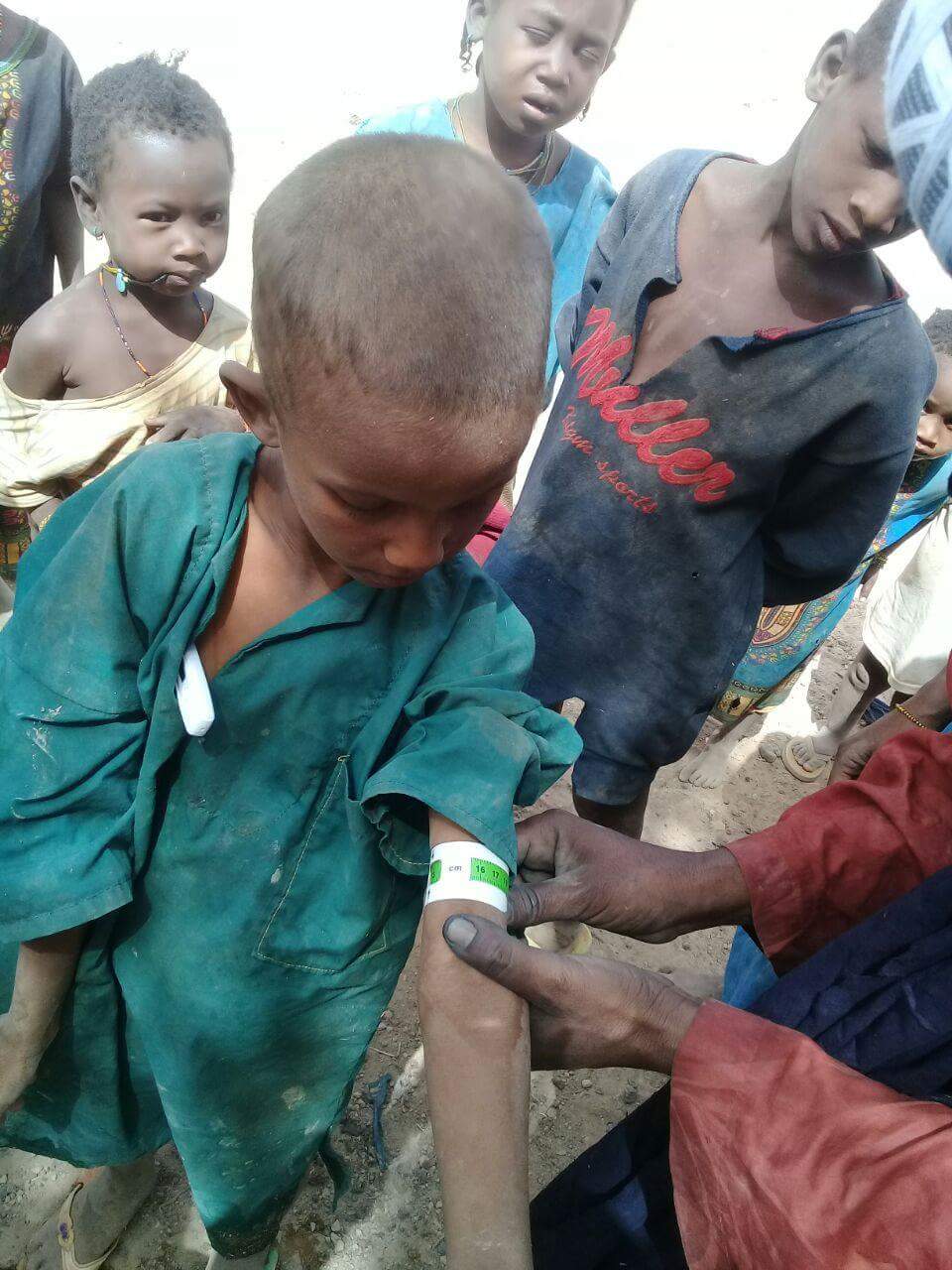 repérage malnutrition