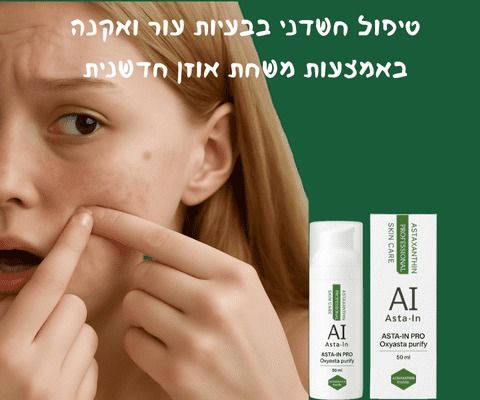 טיפול טבעי באקנה
