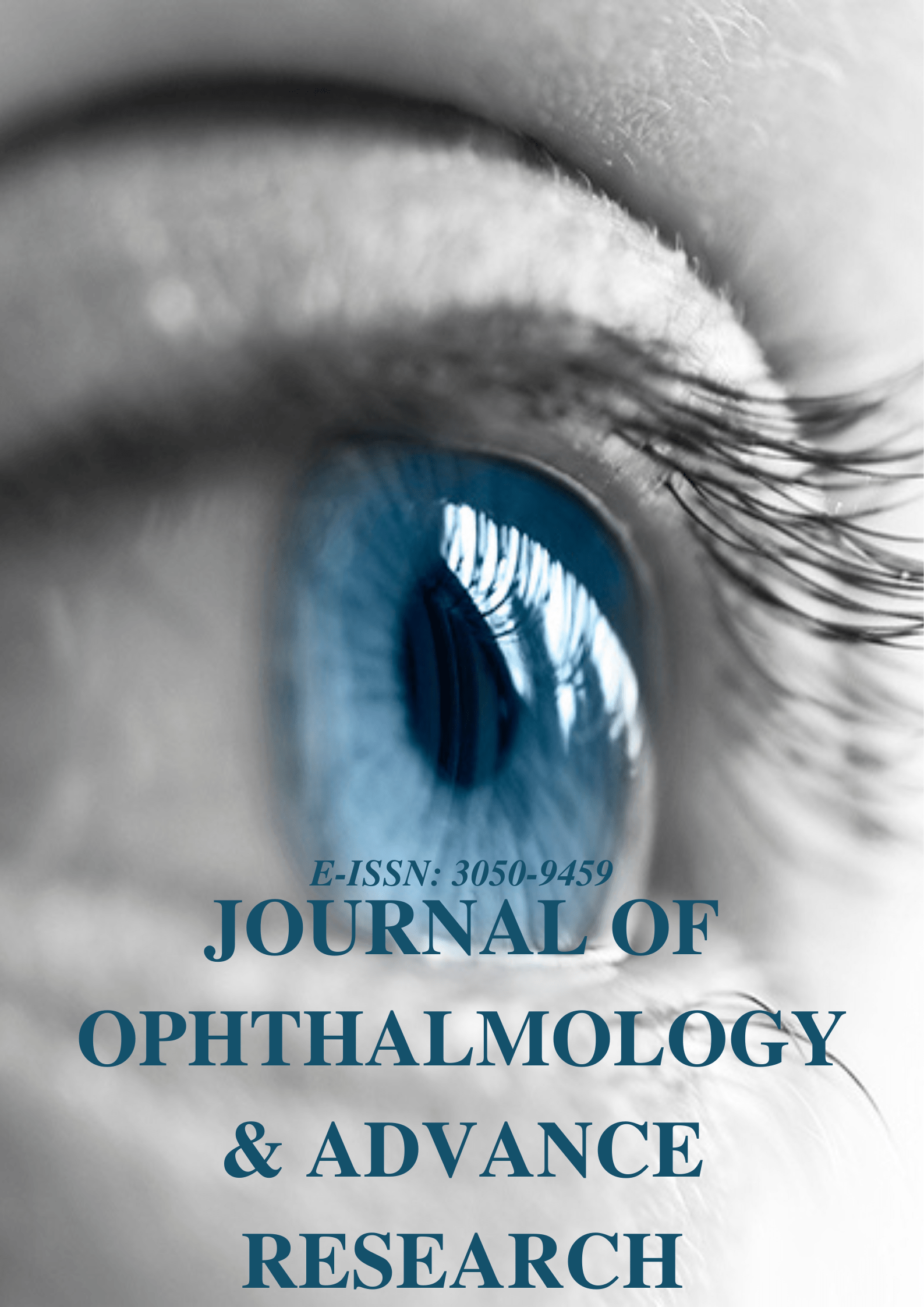 Journal of Ophthalmology and Advance Research