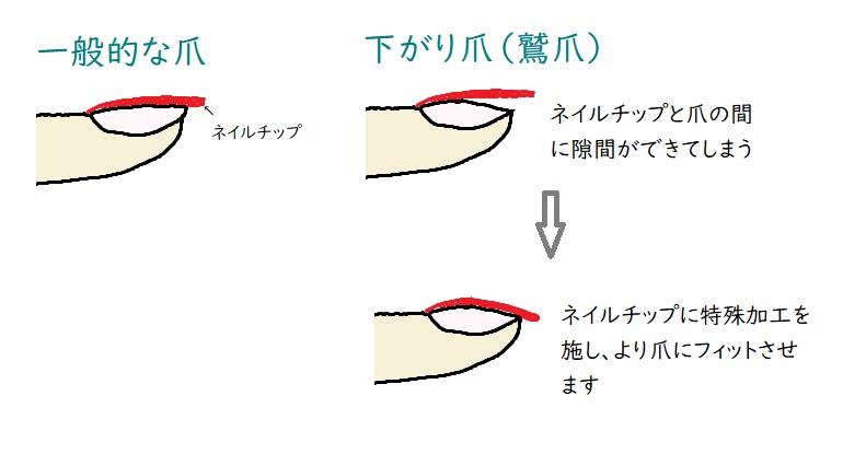 下がり爪 鷲爪 さんでもぴったりフィット ぴったりフィットのネイルチップ専門店 アトリネイル 下がり爪 鷲爪 さんでもぴったりフィット ぴったりフィットのネイルチップ専門店 アトリネイル