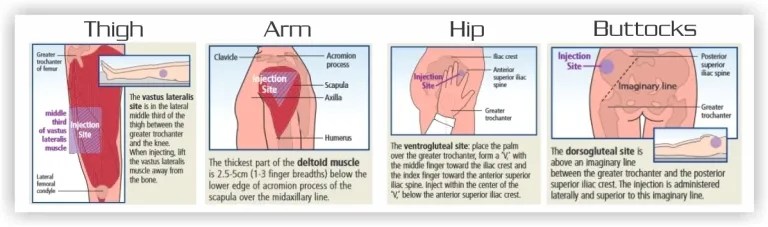 Injection Definition Types Purposes