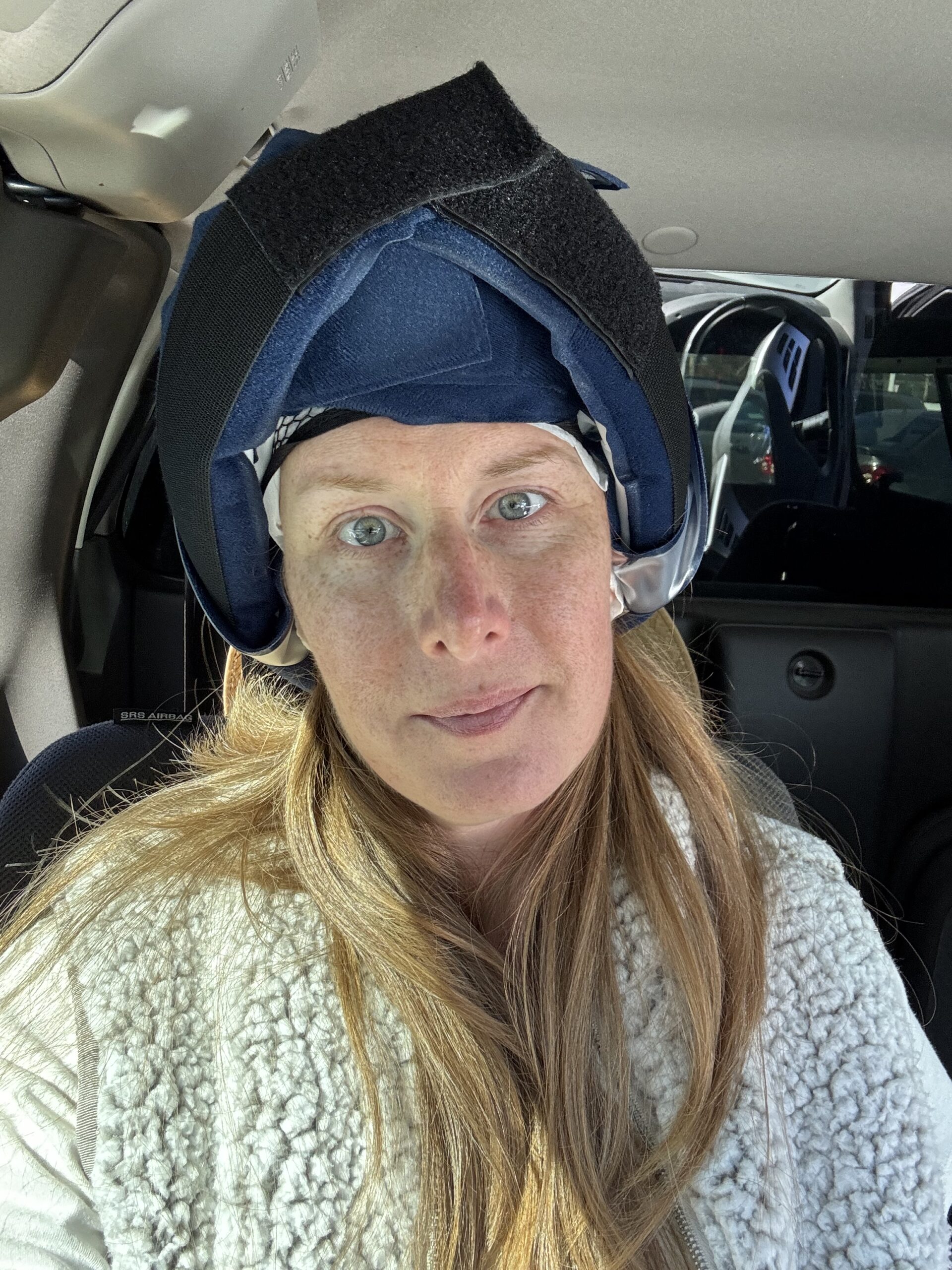Cold capping selfie. Cold capping is used during chemotherapy treatments to mitigate hair loss by freezing the follicles.