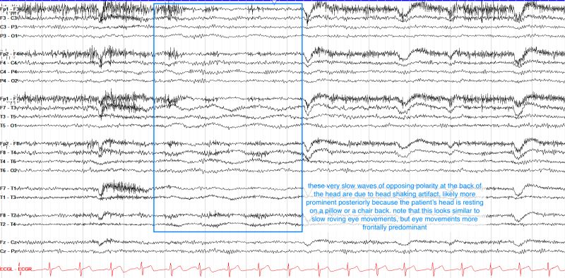 Bme Eeg Analysis Hilbert Transform Aursus - Premium Gradient Art Gallery - Full HD