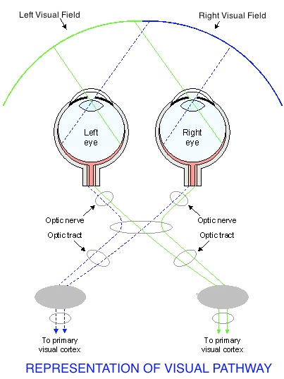 REPRESENTATION OF VISUAL PATH - Autistic Interpretations