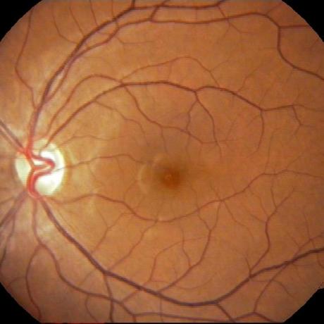 Github Traslational Visual Health Laboratory Code All The Models We - Download Ultra HD Minimal Design | Retina