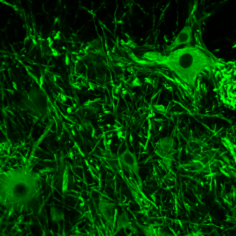 Teijo Teijo Laine Github - Light Pattern Collection - Ultra HD Quality