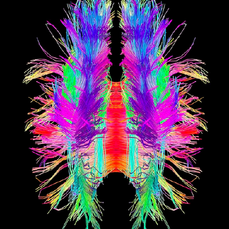 Github Kavonrtep Dante Ltr - Best Light Textures in 8K