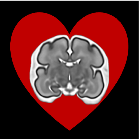 Github Bkainz Fetalreconstruction Gpu Accelerated Source Code For - Download Beautiful Ocean Pattern | HD