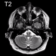 Barry Max1 Github - Sunset Designs - Premium 8K Collection