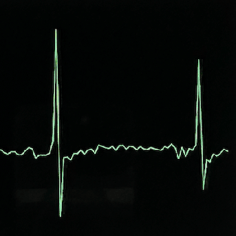 Cardiokit Github - Best Nature Arts in Mobile