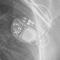 Pacemaker Install Md At Main Clusterlabs Pacemaker Github - Download Modern Dark Design | Mobile