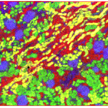 Nhpatterson Heath Patterson Github - Best Vintage Images in 8K