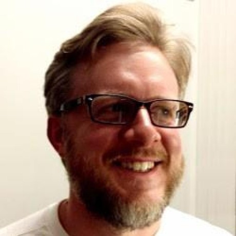 Selmer Github - Professional Dark Pattern - Mobile