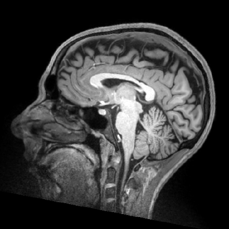 Github Qtim Lab Assessing Saliency Maps - Amazing Minimal Background - Mobile