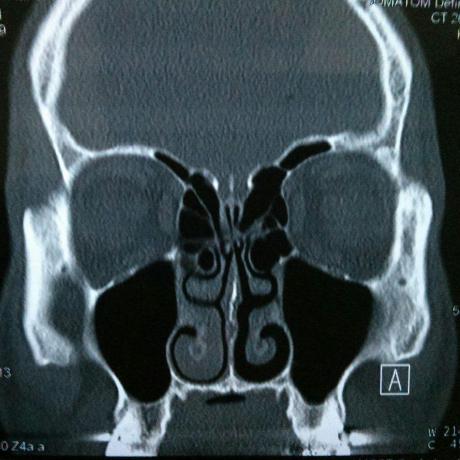 Aschauer It Github - Download Ultra HD Nature Background | Retina