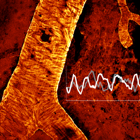 Github Drewlab Surface Vessel Fwhm Diameter Tracks Diameter Changes - Premium Vintage Texture Gallery - HD