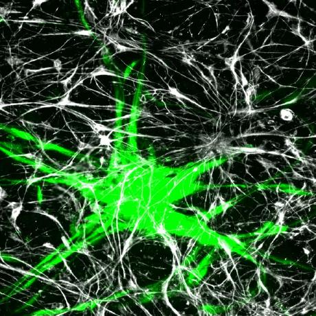 Github Themilolab Spata2 A Toolbox For Spatial Gene Expression Analysis - Ultra HD Geometric Images for Desktop