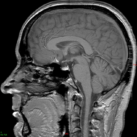 Robert Hall Bbr Robert Hall Github - Premium Light Art Gallery - 4K