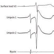 Prash Prash Github - Premium Geometric Picture Gallery - 8K