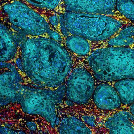 Ajinkya Kulkarni Medium - Best Abstract Pictures in Mobile