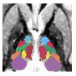 Github Thalamicseg Hipsthomasdocker Docker Version Of Hips Thomas - Gradient Wallpapers - Incredible Mobile Collection