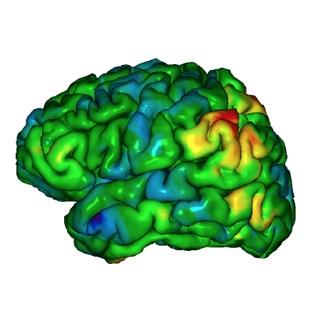 Github Radiome Lab Preprocessing Anatomical Preproc In Radiome - Best Abstract Patterns in 4K