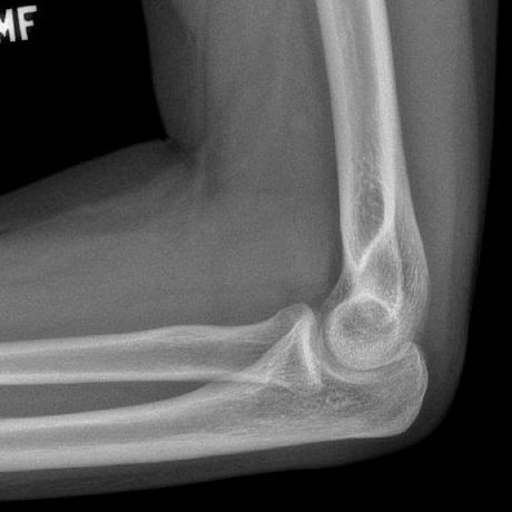 Github Leftoelbow Portalstutorial - Professional Minimal Photo - Mobile