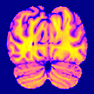 Fmrianalysiscourse Github