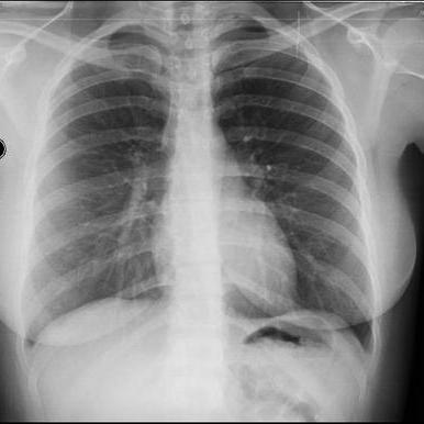 Github Nayla311 Naila Pusing 4 - High Quality Ultra HD Minimal Patterns | Free Download