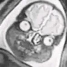 Soliblue Soli Github - Incredible Mountain Picture - 8K