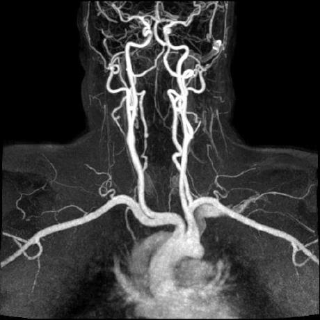 Adam Koch Observable - Sunset Designs - Modern 4K Collection