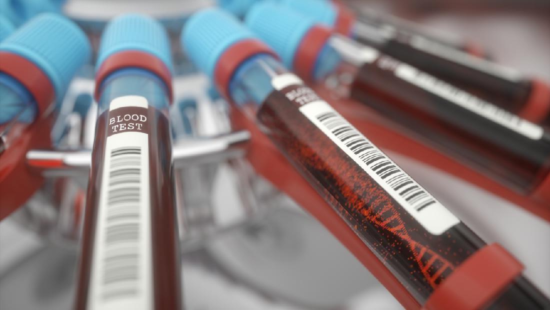 Wanita Ini Iseng Lakukan Tes DNA ke Pasangan, Hasilnya Bikin Kaget